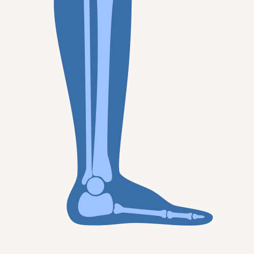 Orthotics & Foot Lifts