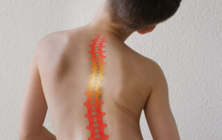 Can scoliosis adolescents be reversed