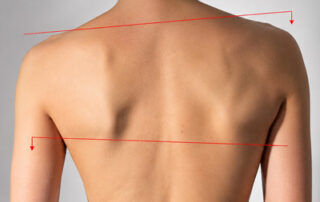 Uneven hips, one shoulder higher, or a crooked feeling