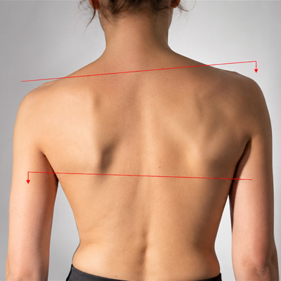 Uneven hips, one shoulder higher, or a crooked feeling Uneven hips, one shoulder higher, or a crooked feeling